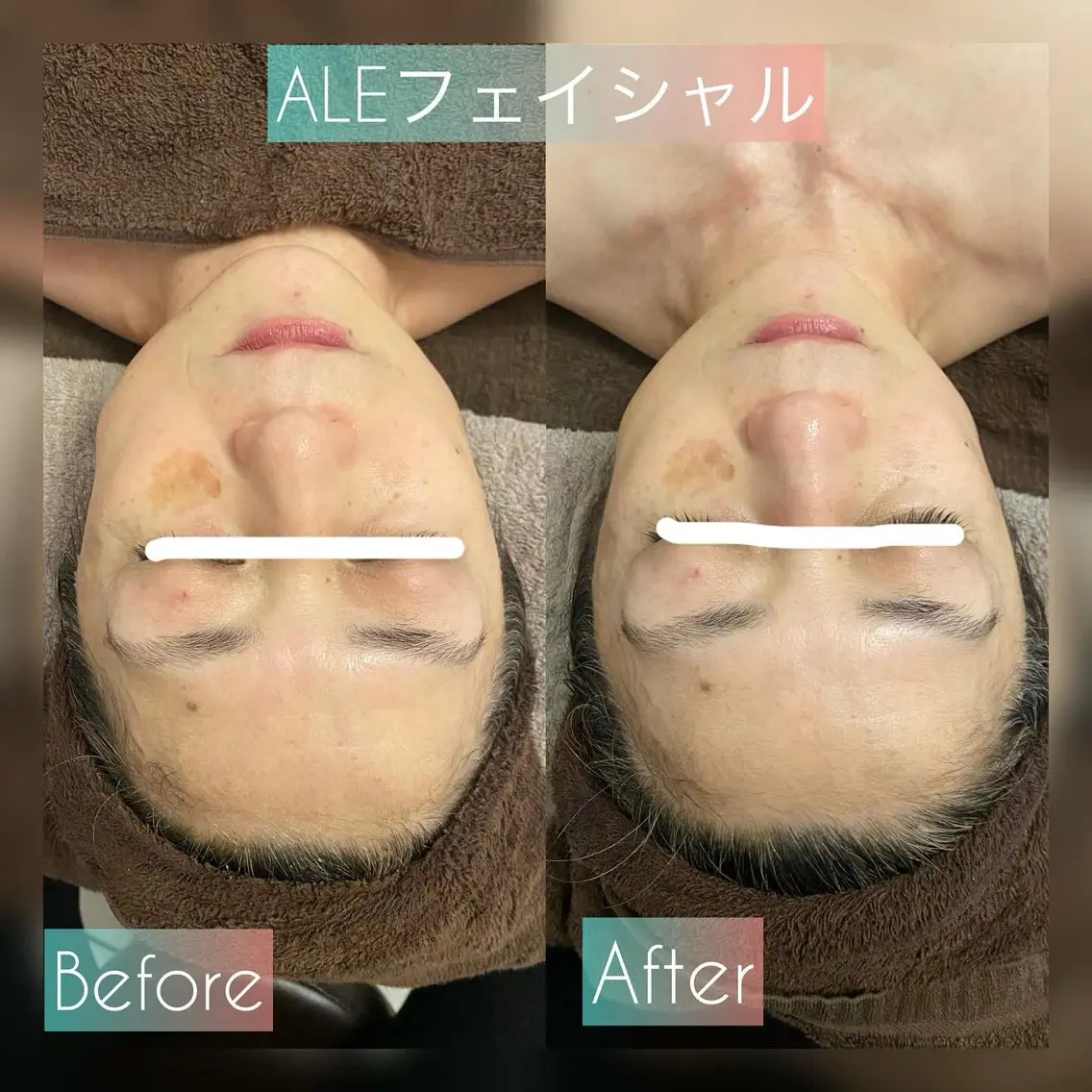 エステ AquaGarden 小顔・ツヤ肌ケアのエステ・リラクイメージ