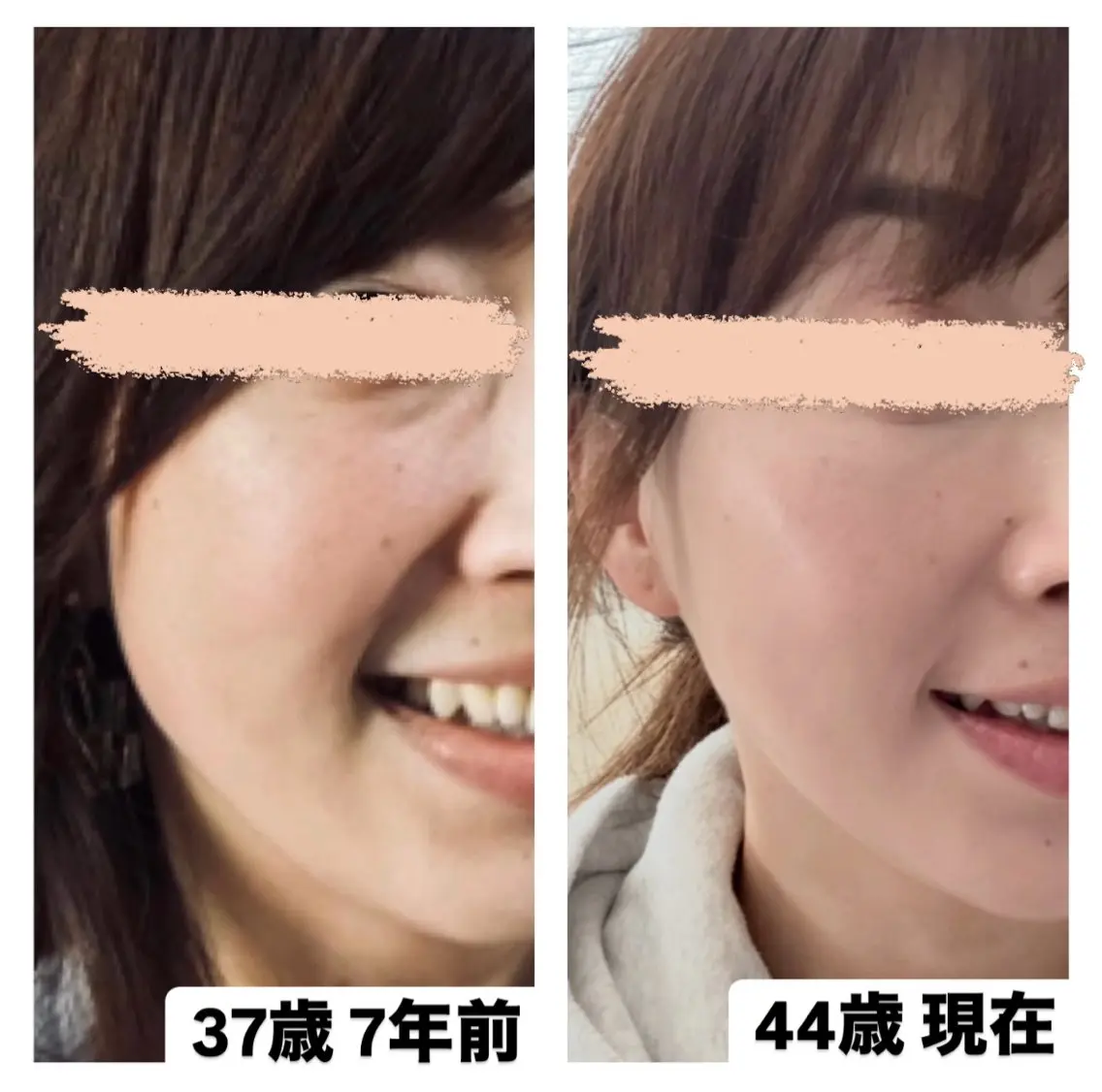 35歳からの エイジングケアサロンのエステ・リラクイメージ