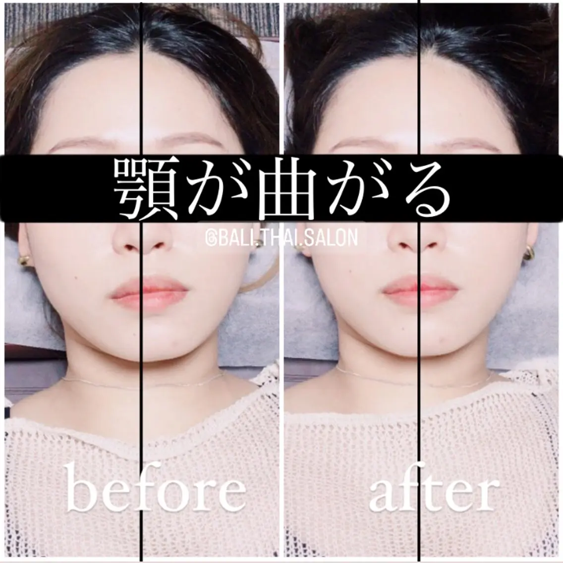 🌈歪み専門🌈 バリンタイ すぎうらのエステ・リラクイメージ