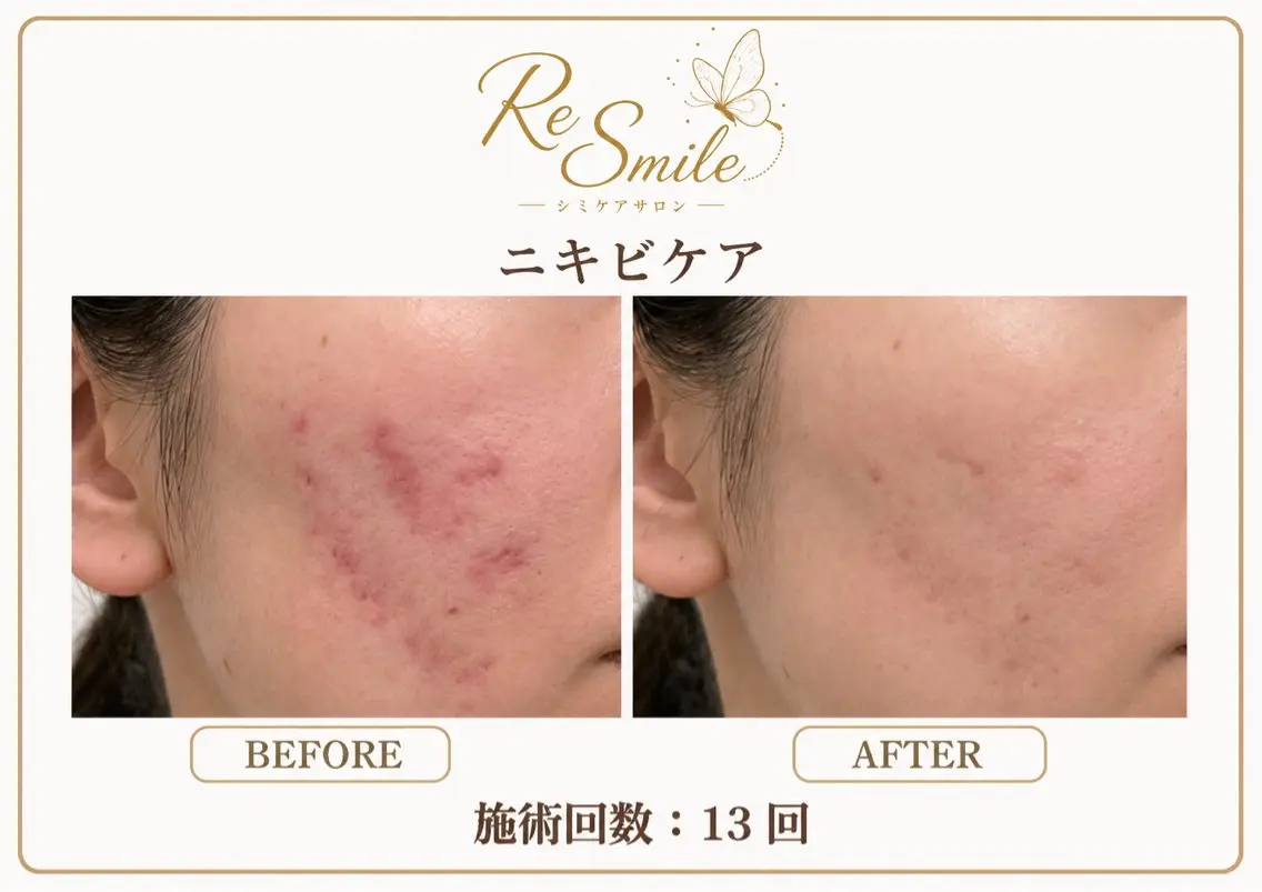 ReSmile (リスマイル)のエステ・リラクイメージ