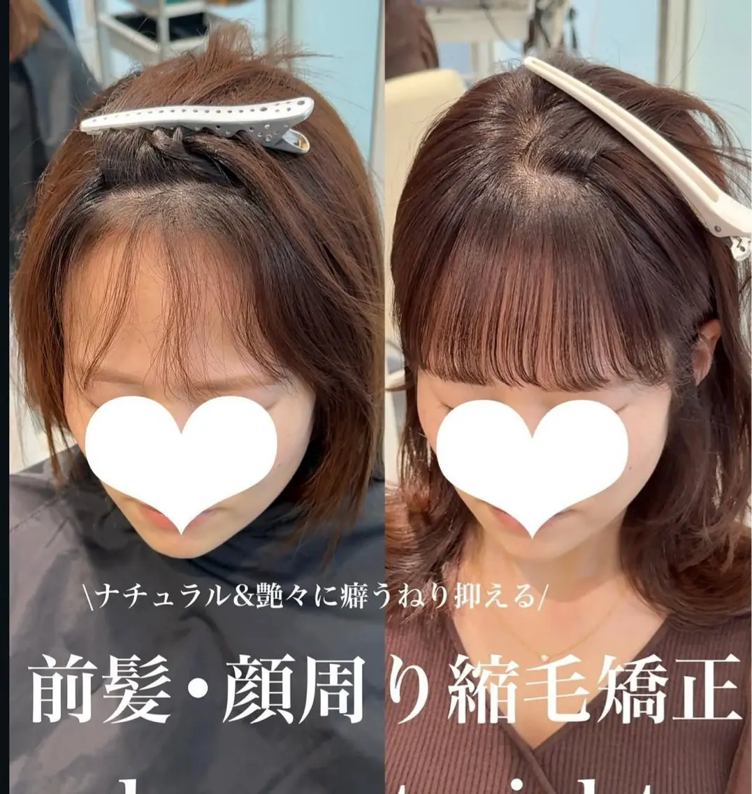 前髪縮毛矯正の写真