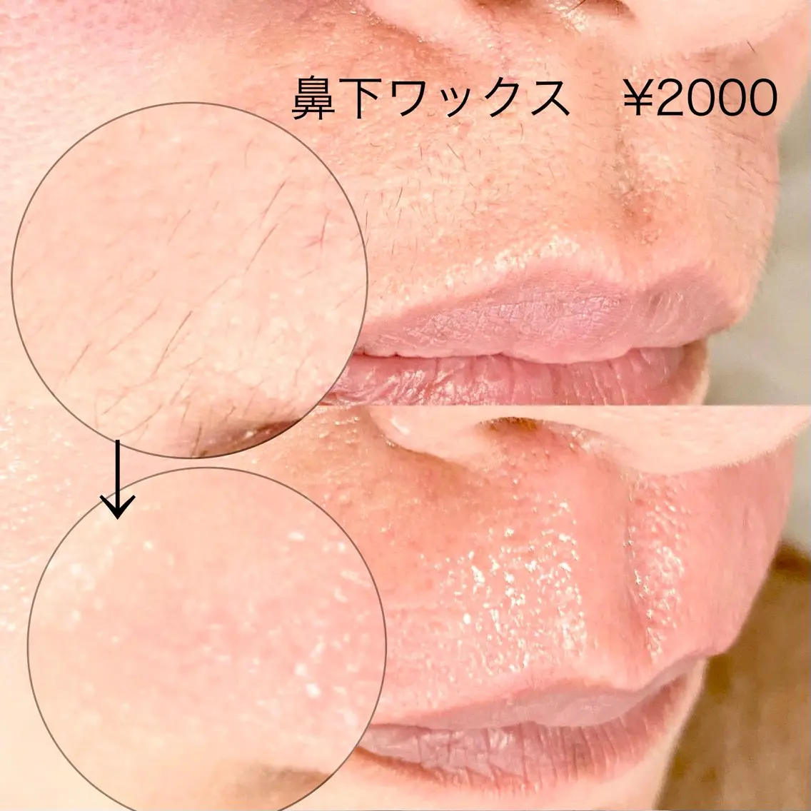 アイブロウ 眉毛ワックス脱毛 ワックス脱毛 フルールFululu 自由が丘のマツエク・マツパデザイン