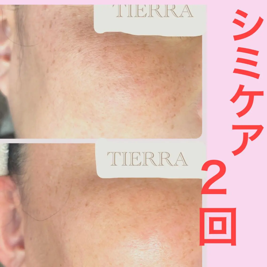 TIERRA ♡のエステ・リラクイメージ