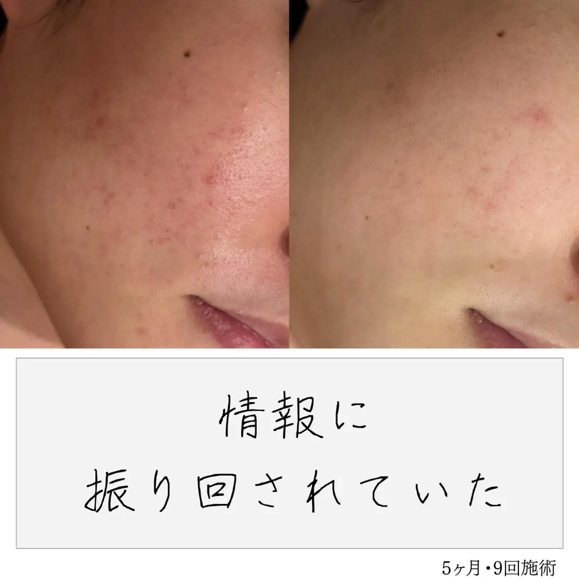 ニキビ経験者が施術 する専門サロン🌻のエステ・リラクイメージ