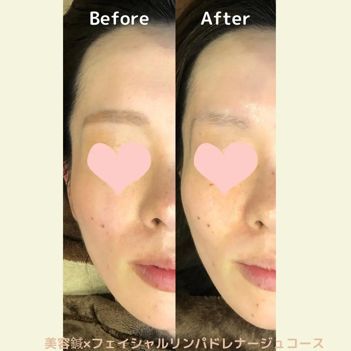 鍼灸サロン Sakuraのエステ・リラクイメージ