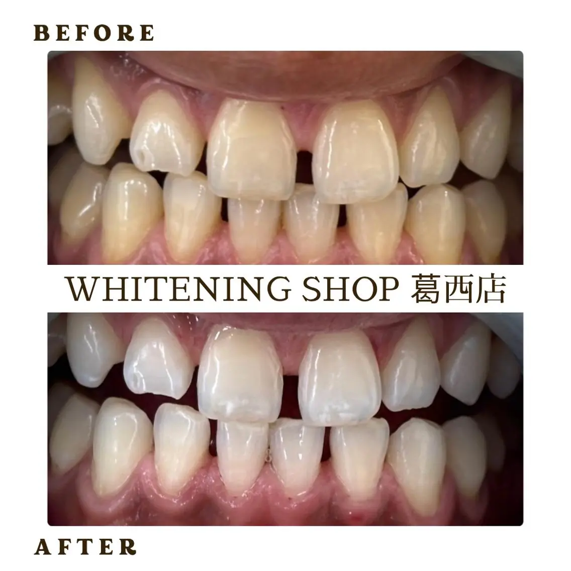 メンズ その他 ホワイトニング ショップ葛西店のその他イメージ