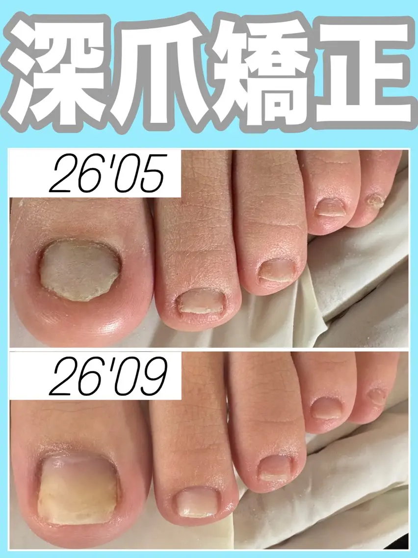 ネイル フットネイル nail salon petillantのネイルデザイン