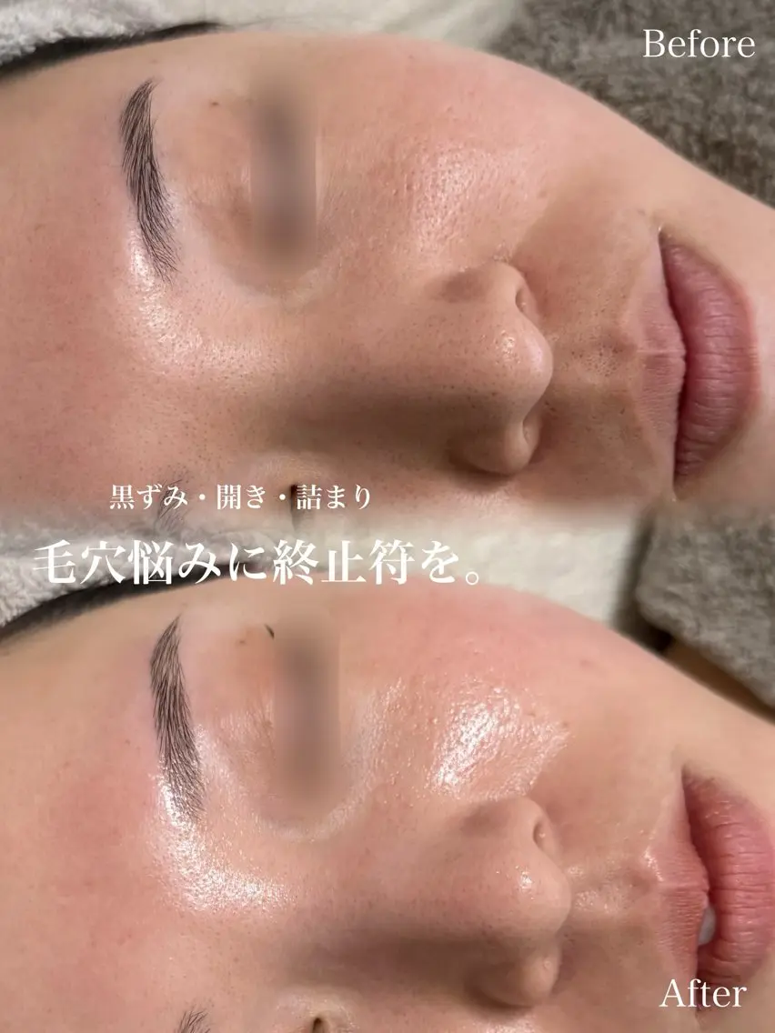 エステ SALON el KARINのエステ・リラクイメージ