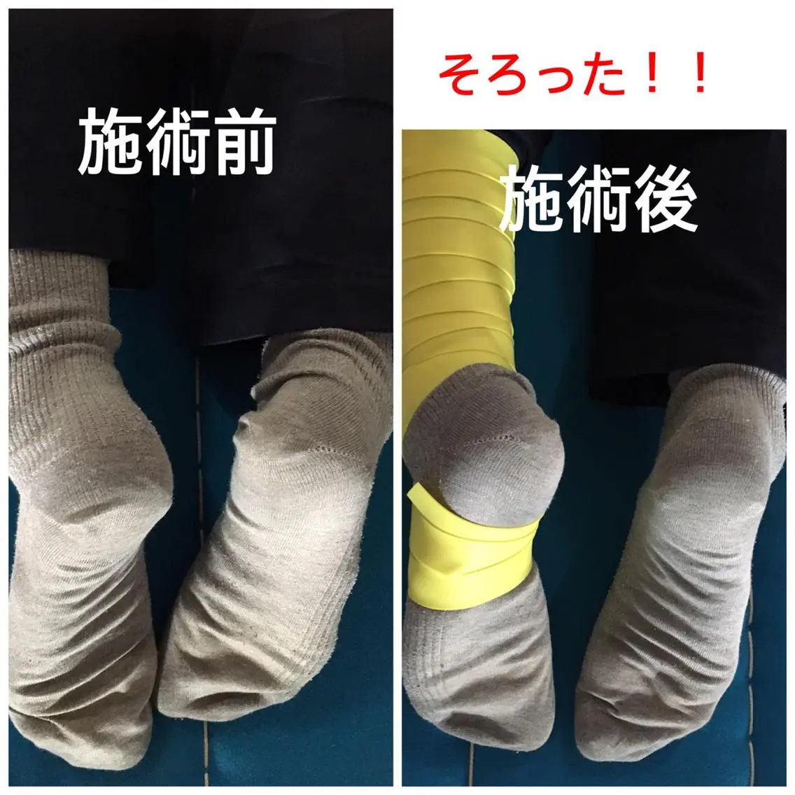 骨盤調整【体験】の写真