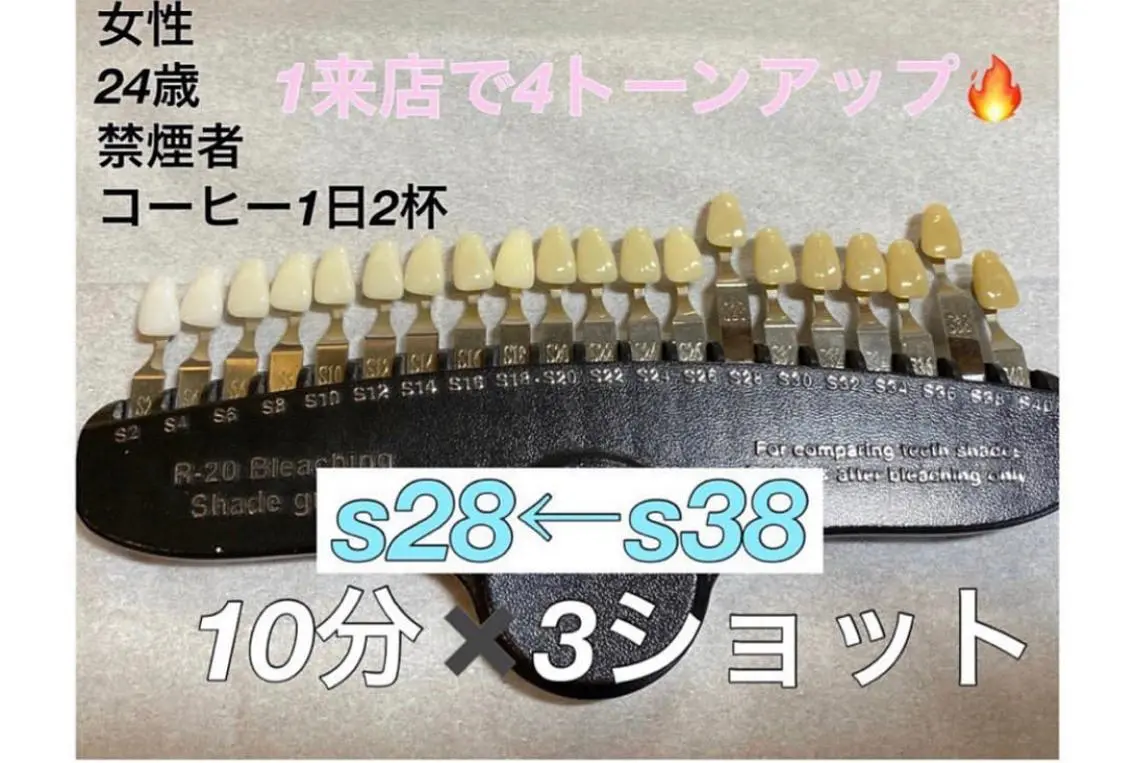 銀座de ホワイトニングのその他イメージ