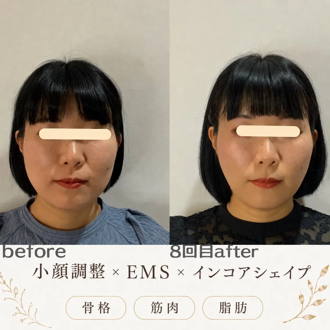 エステ リラク 最速小顔・肌管理 espoir 阿部のエステ・リラクイメージ