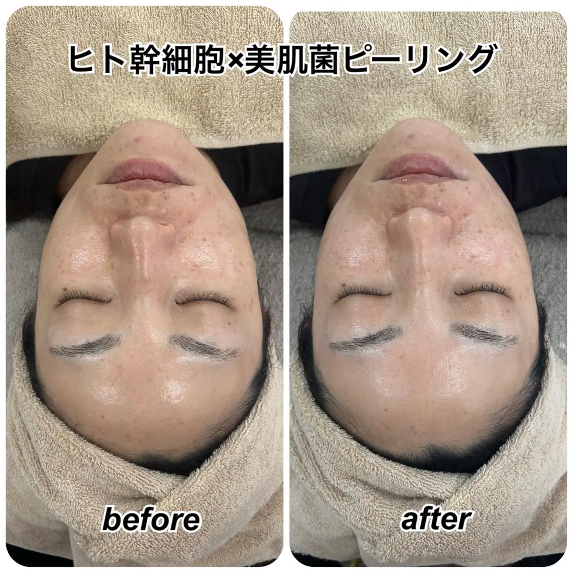 エステ エステサロン Venusのその他イメージ