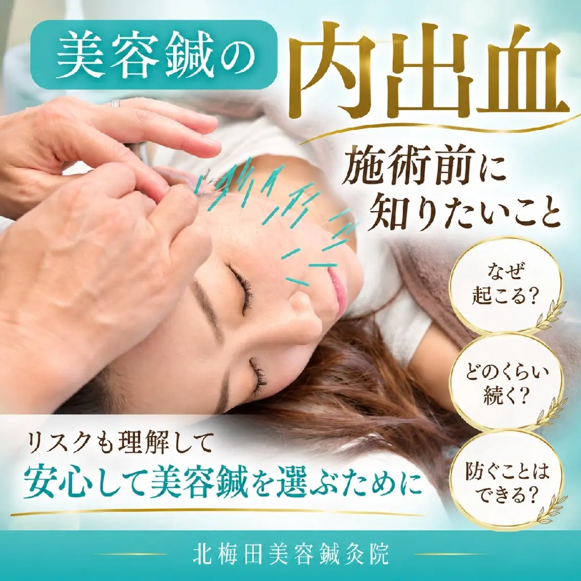 エステ リラク 美容鍼マイスター 川村　淳のエステ・リラクイメージ