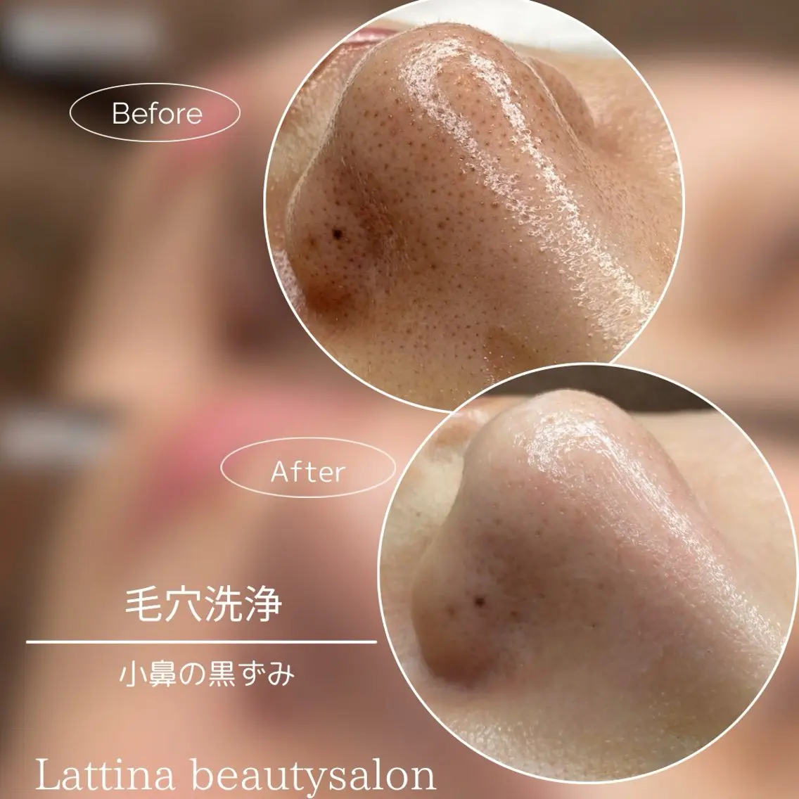Lattina ラティーナのエステ・リラクイメージ