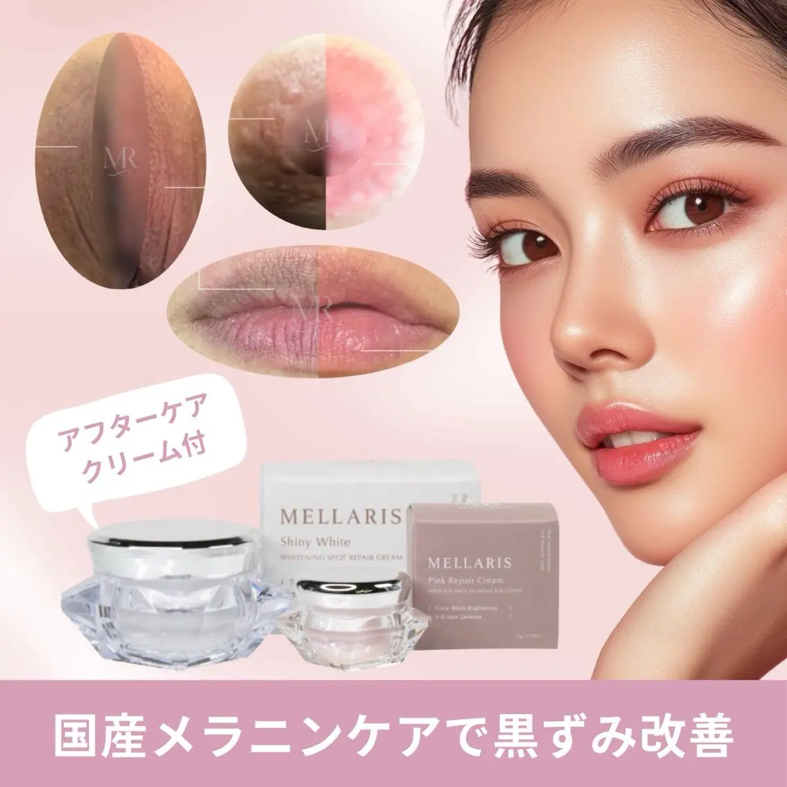 エステ ハーブピーリング肌 管理🌿Ante関内のエステ・リラクイメージ