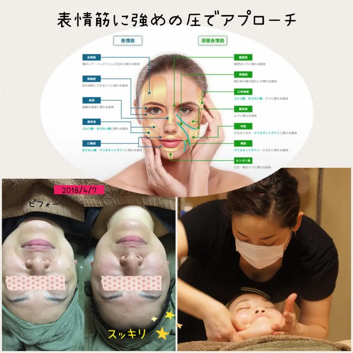 顔筋小顔ケア& 超音波 でリフトup 60分 強めの圧で流します。 パック付き 首肩も流します。の写真