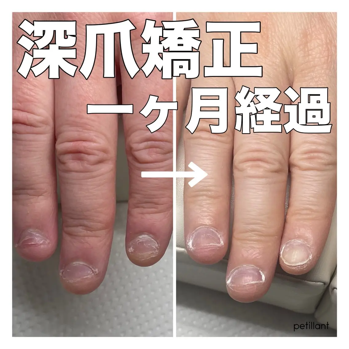 ネイル 長さ出し ジェルネイル nail salon petillantのネイルデザイン