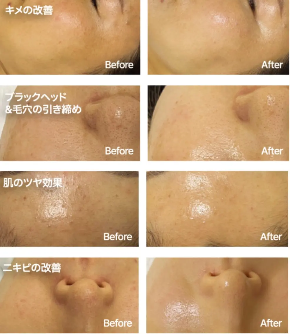 佐々木 ちゆきのエステ・リラクイメージ