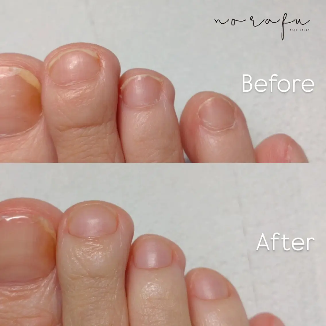 ネイル nail 　norafu.のネイルデザイン