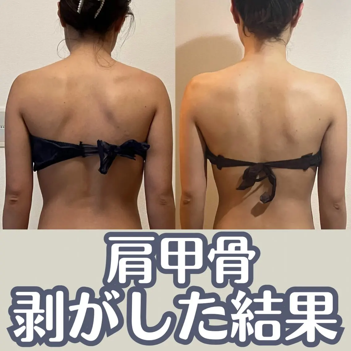 小顔矯正/骨格矯正 AKANEのエステ・リラクイメージ