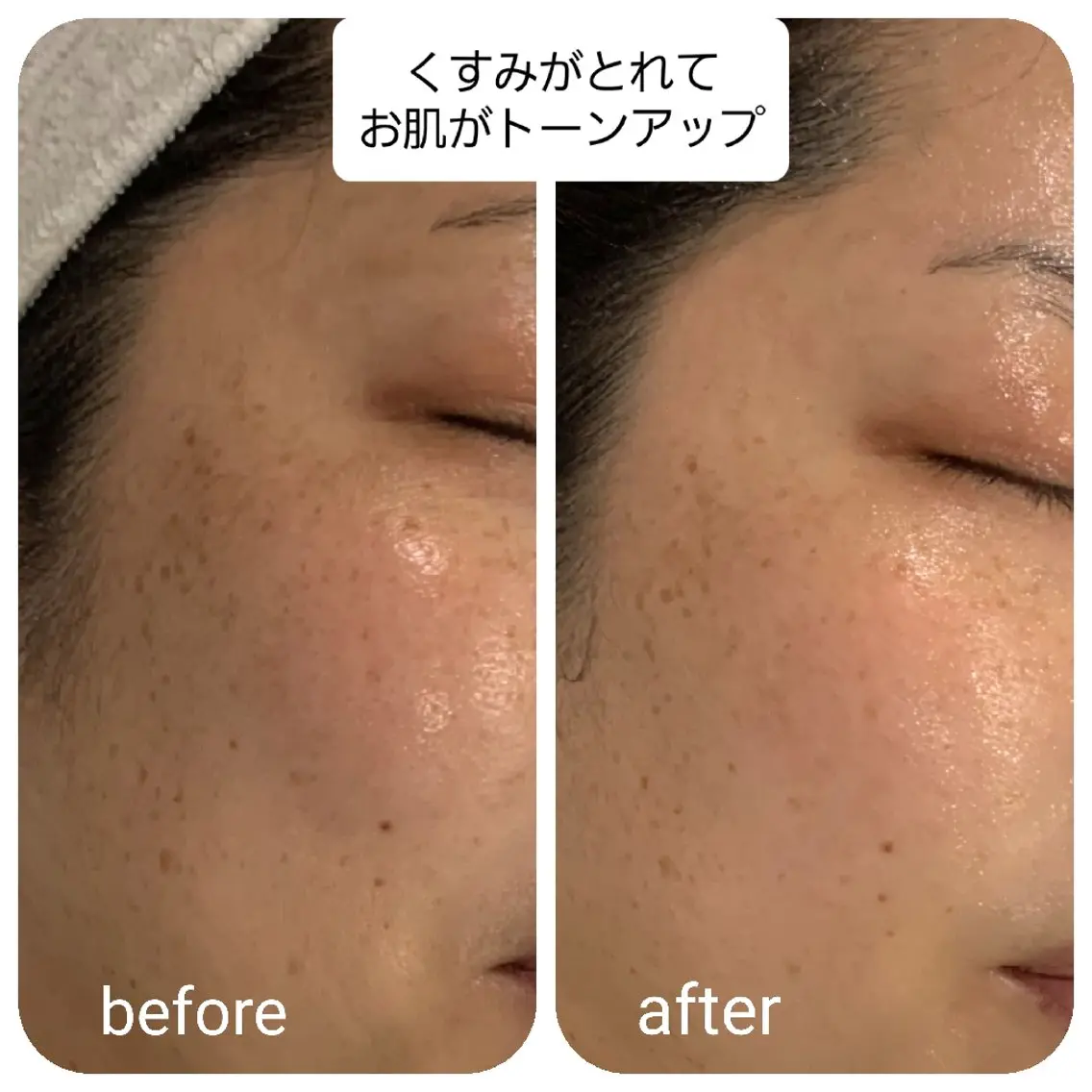【デコルテ付き】オールハンド美肌フェイシャル✨の写真