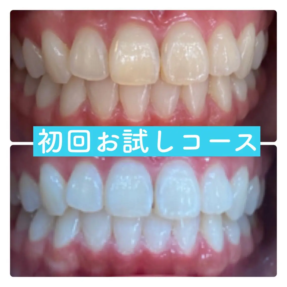 ホワイトニングルーム 横浜店のその他イメージ