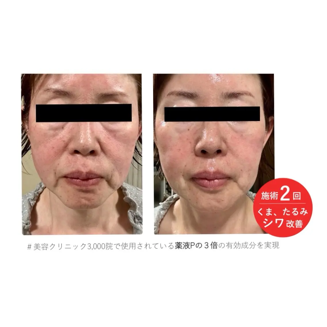 その他 LUMINAルミナ 【肌管理サロン】のその他イメージ