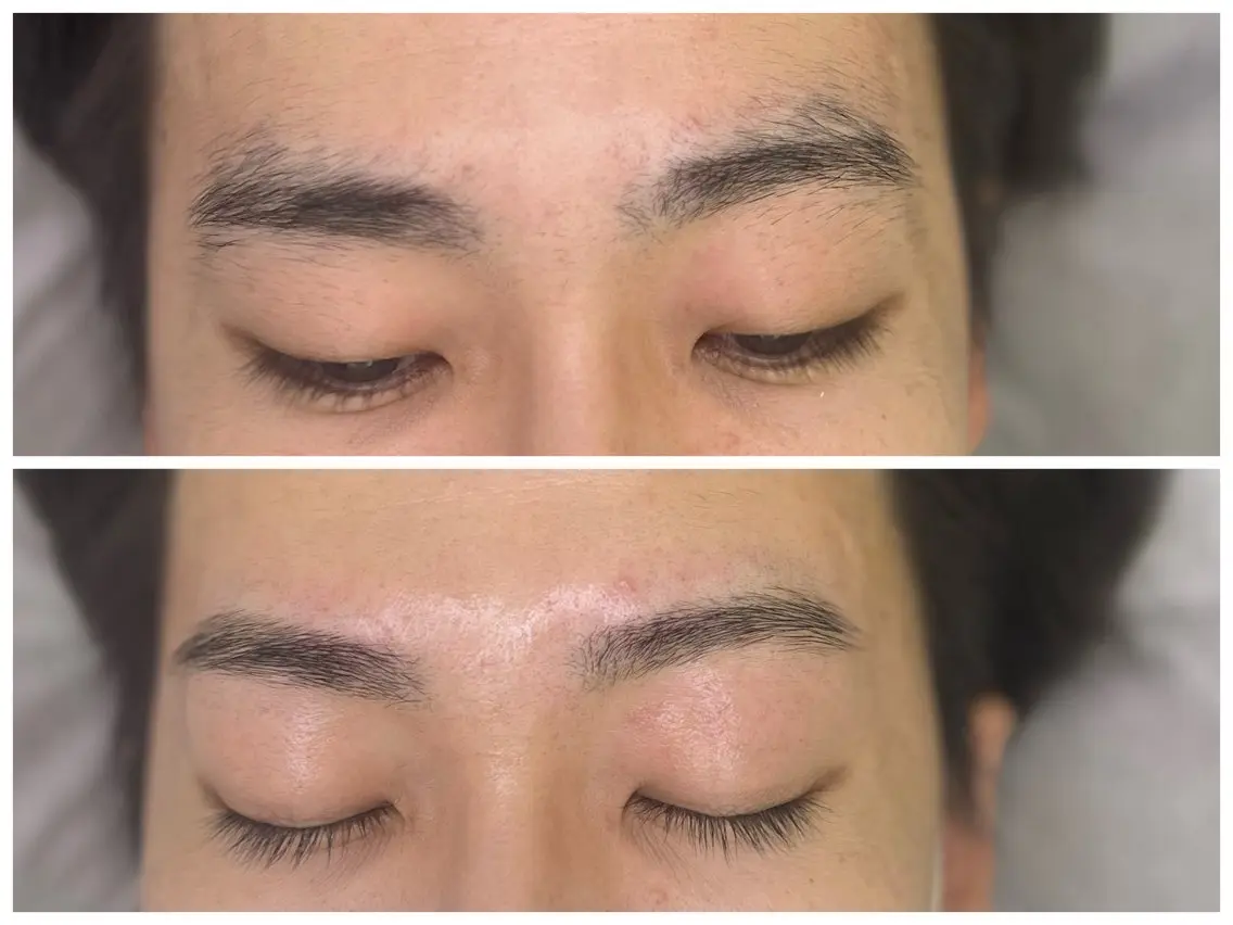 メンズ アイブロウ ワックス脱毛 眉カット その他(アイブロウ) 眉毛/美肌の専門店 Mily🍒ミウィの眉毛・アイブロウイメージ