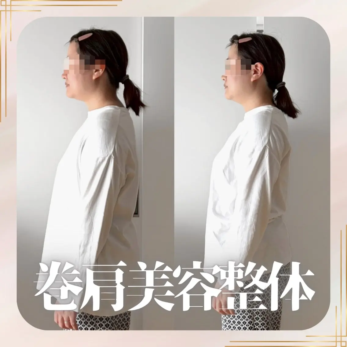 〈巻肩、肩こりに👌〉巻肩美容整体＋ヘッドの写真