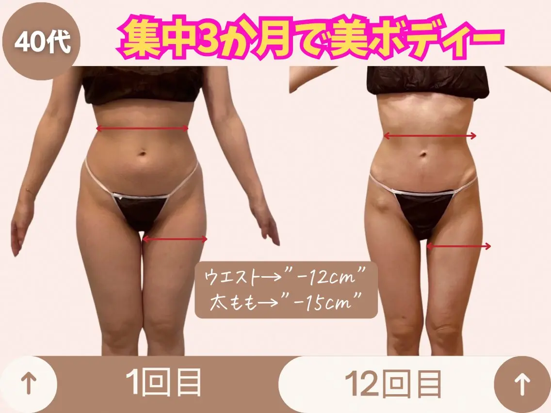 (初回限定)女性に人気の全身ボディメイク痩身 (お試し)の写真