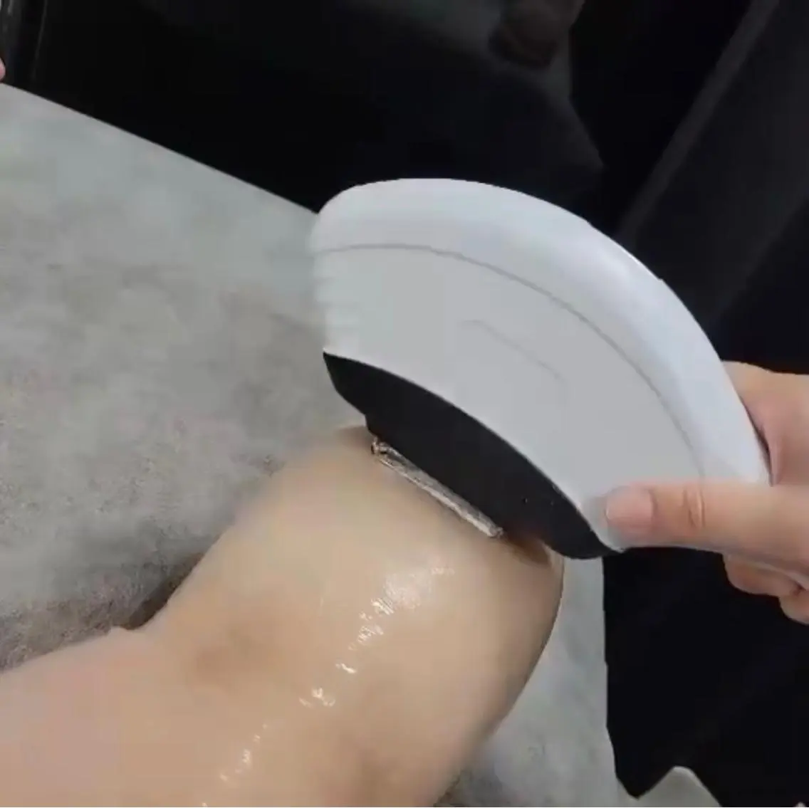 Mパーツ【襟足、腰、(レディースのみ:VIO)(メンズのみ:あごヒゲ、頬ヒゲ)のいずれか1パーツ】美肌脱毛の写真