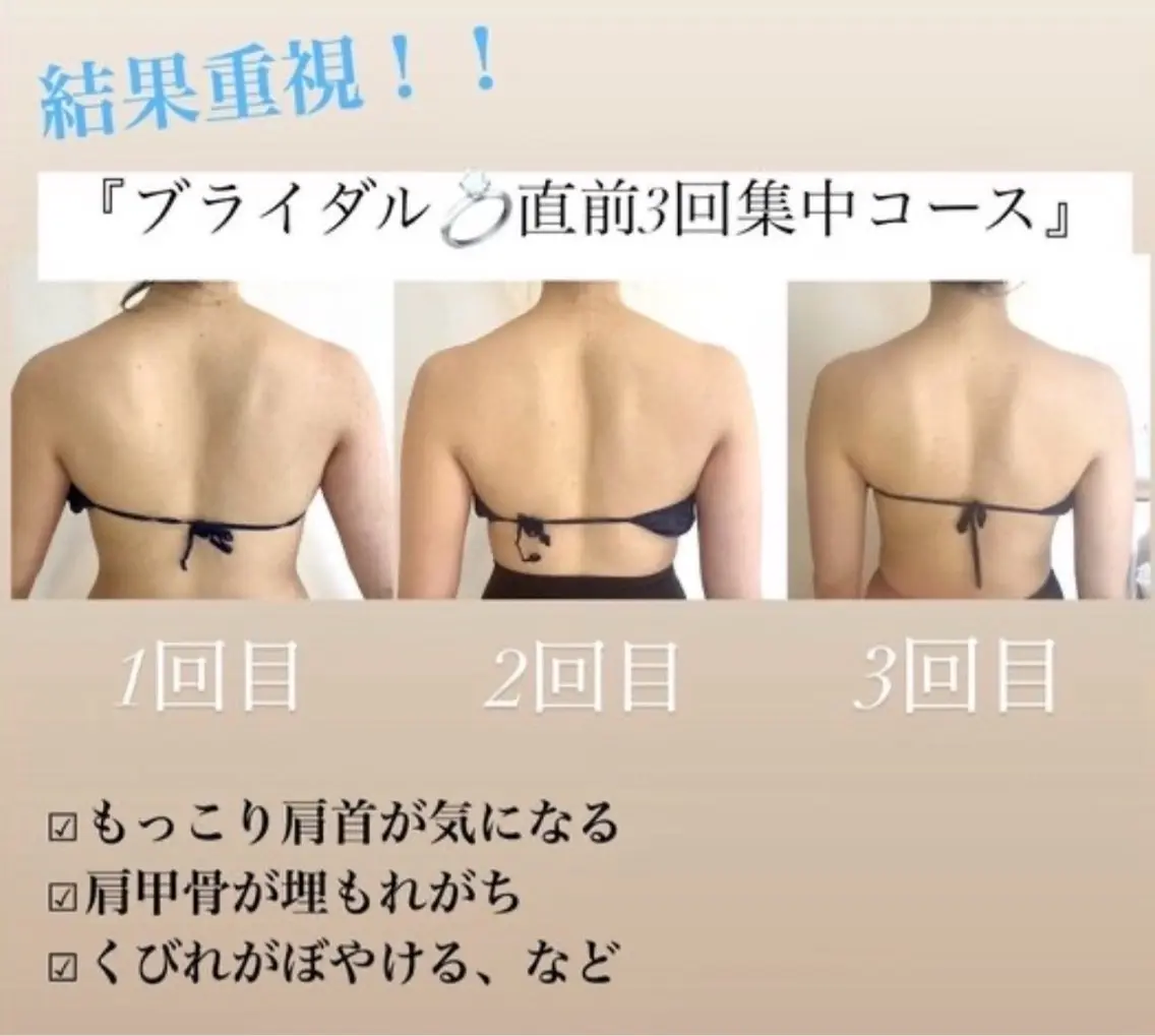 【とにかく結果重視！】ブライダル直前3回集中コース痩身上半身＋痩身マシン80分 52800→37800の写真
