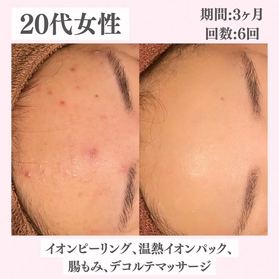 エステ リラク ニキビ・肌質改善専門 ♡人生が変わるサロンのエステ・リラクイメージ
