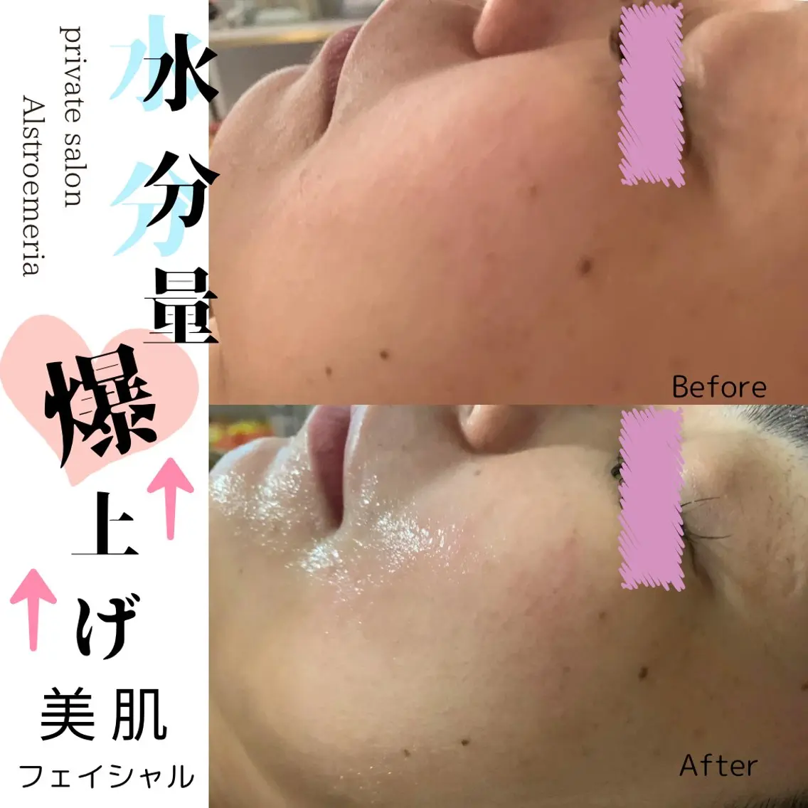 モニターご協力の方✨限定♡オールハンド美肌フェイシャル💆‍♀️の写真