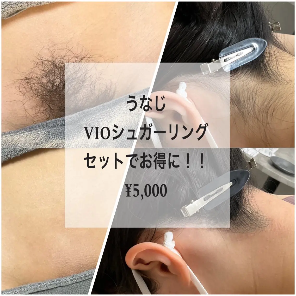沼中 脱毛のエステ・リラクイメージ