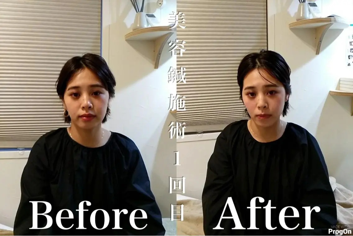 鍼灸 Refineのその他イメージ