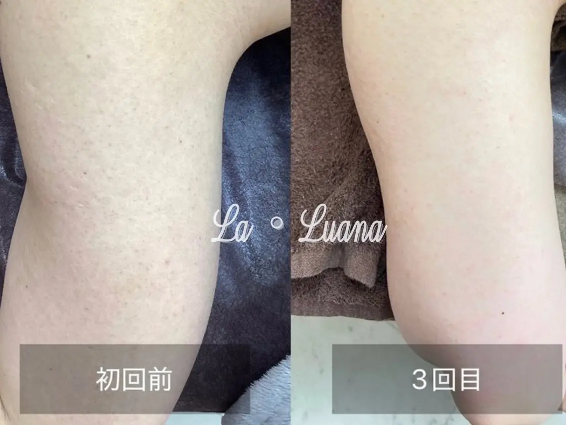 La・Luana Cocoroのエステ・リラクイメージ