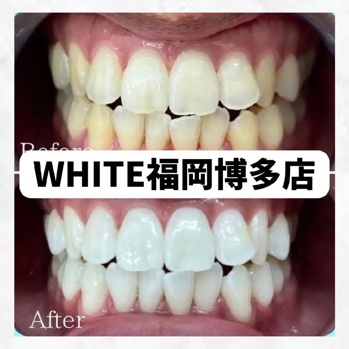 メンズ 撮影モデル セルフホワイトニング WHITE福岡博多店のエステ・リラクイメージ