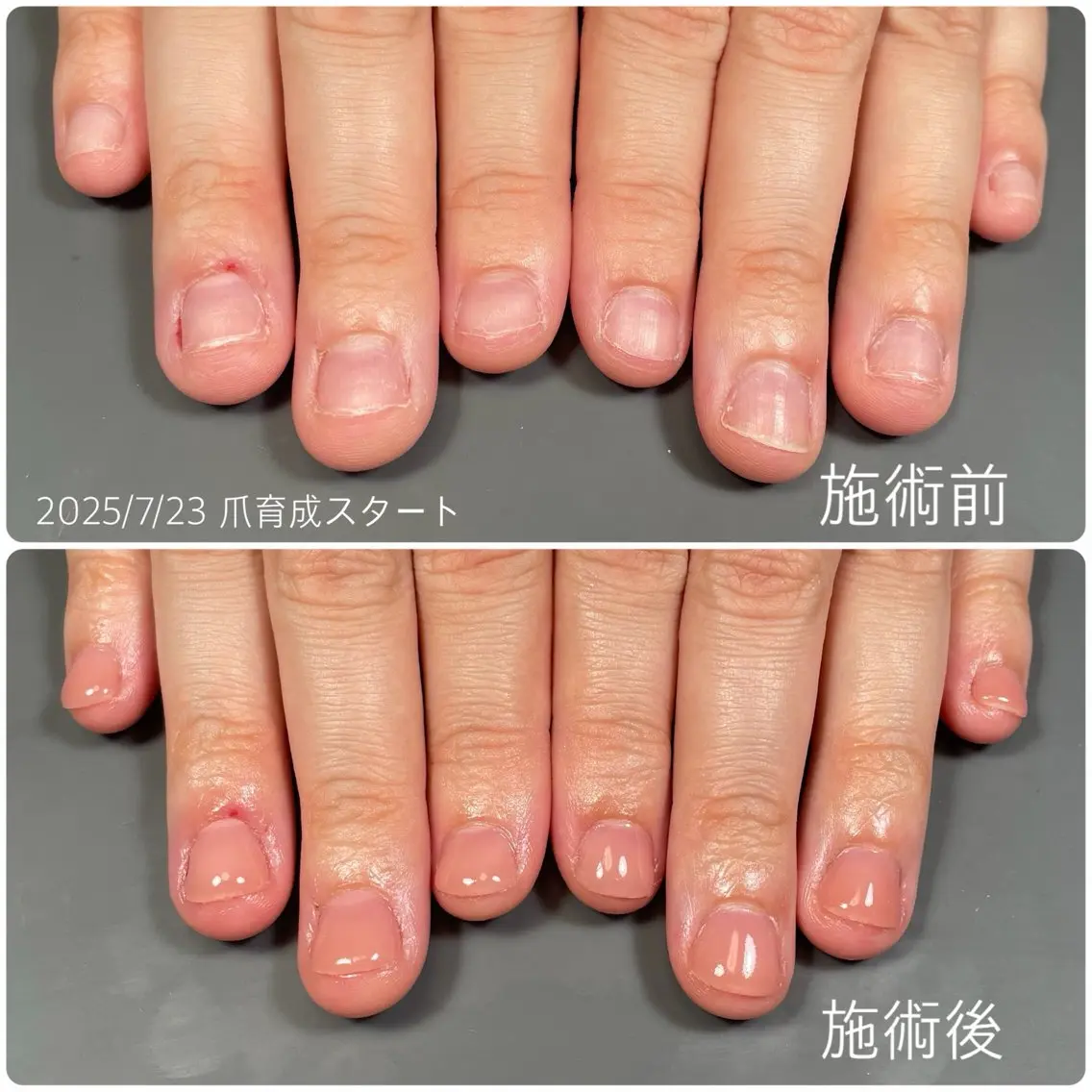 ネイル ジェルネイル 卒業式 ハンドネイル 後藤 ももえのネイルデザイン