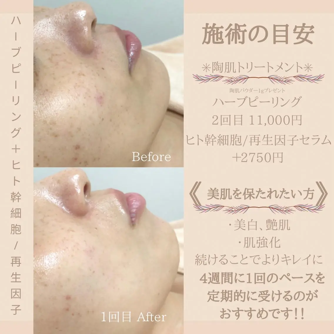 ショート カラー パーマ ヘアアレンジ メンズ キッズ ネイル マツエク・マツパ アイブロウ アイブロウサロン muni 福島区野田の眉毛・アイブロウイメージ
