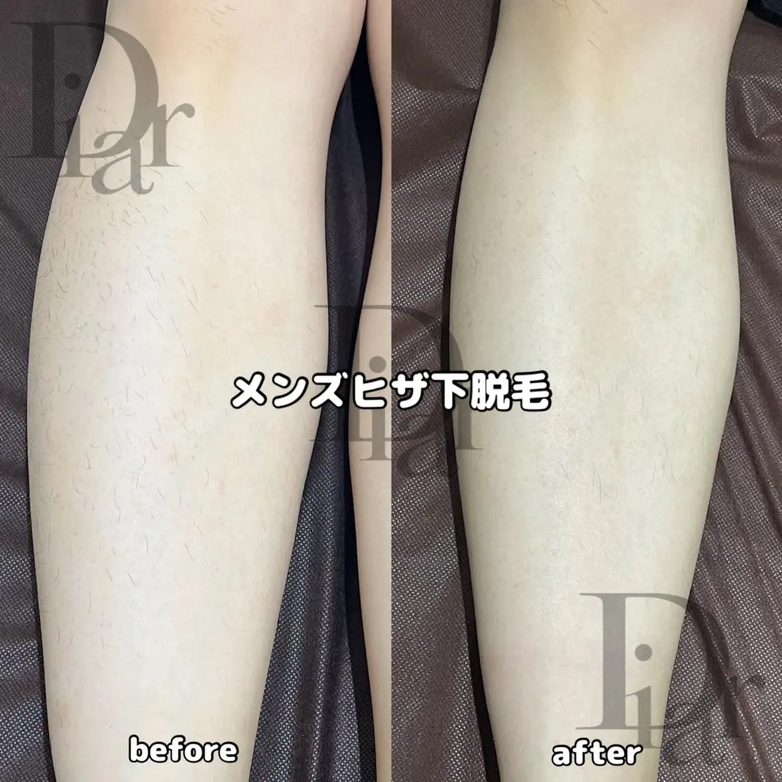 メンズ Diar salon もものエステ・リラクイメージ