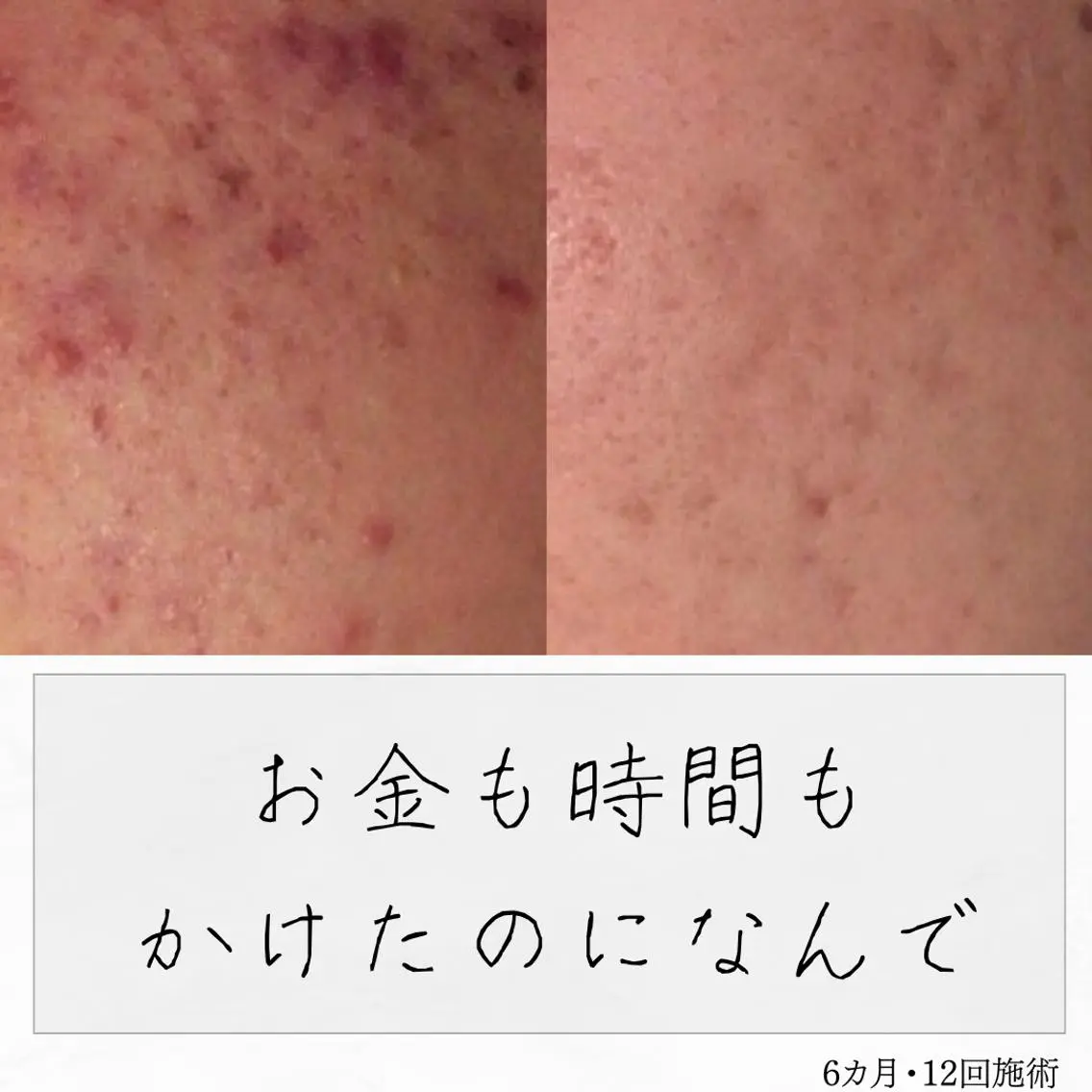 ニキビ経験者が施術 する専門サロン🌻のエステ・リラクイメージ