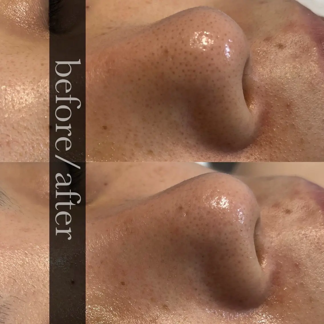 FOXYLASH inoueのエステ・リラクイメージ