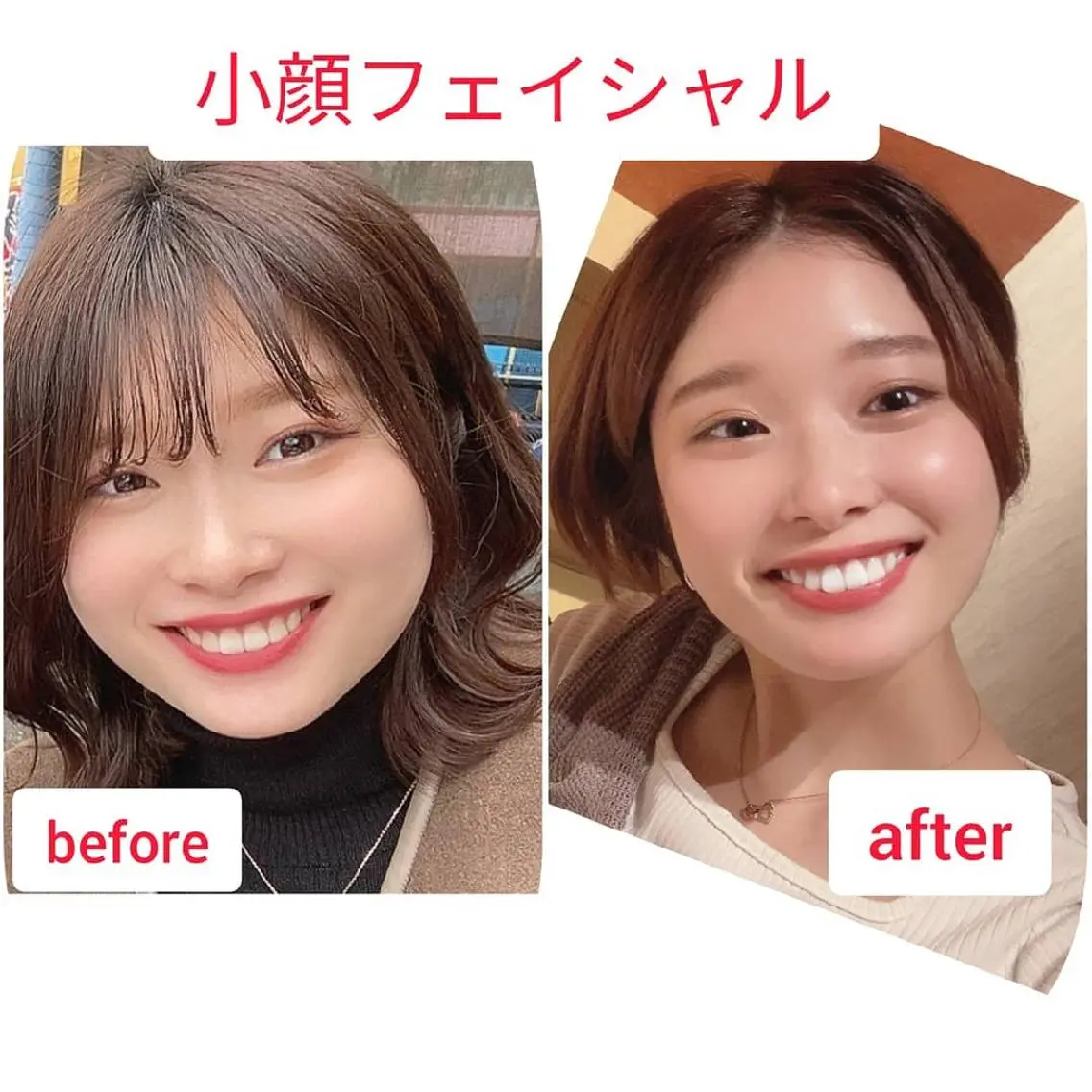 小顔&たるみアップ 専門店リラーシェのエステ・リラクイメージ