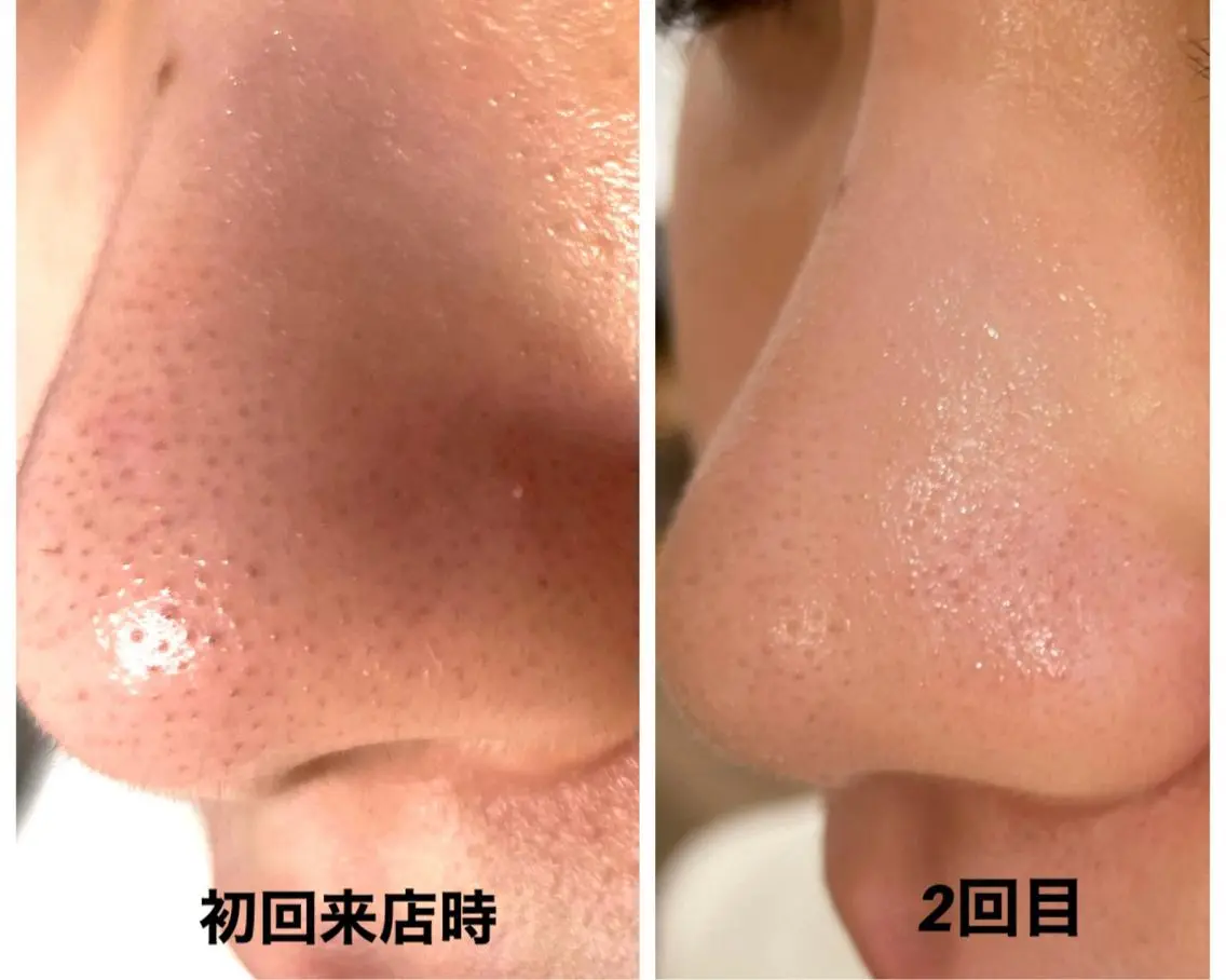 小林 玲菜のエステ・リラクイメージ