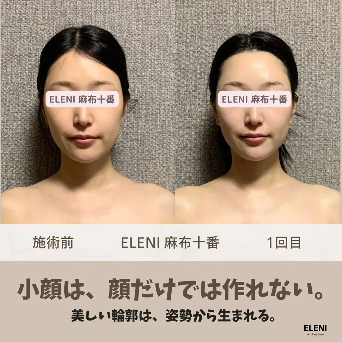 麻布十番小顔コルギ 姿勢矯正リアン💗のエステ・リラクイメージ