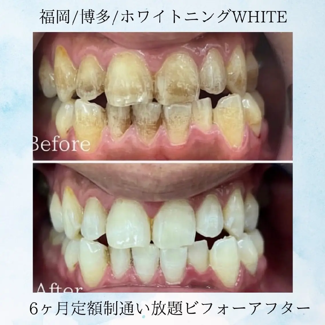 セルフホワイトニング WHITE福岡博多店のエステ・リラクイメージ
