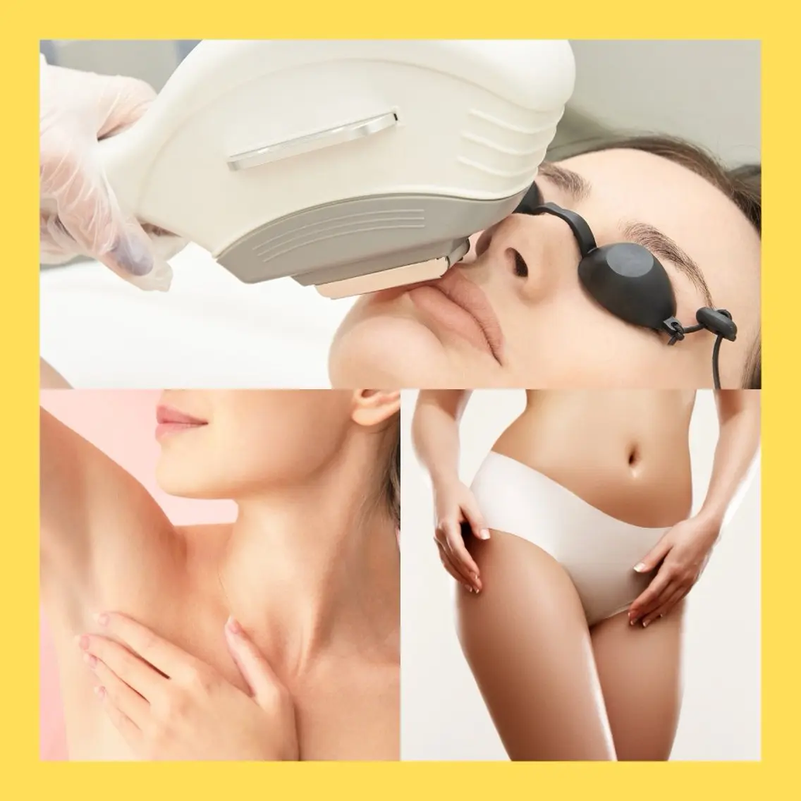 【期間限定】女性の全身脱毛の写真