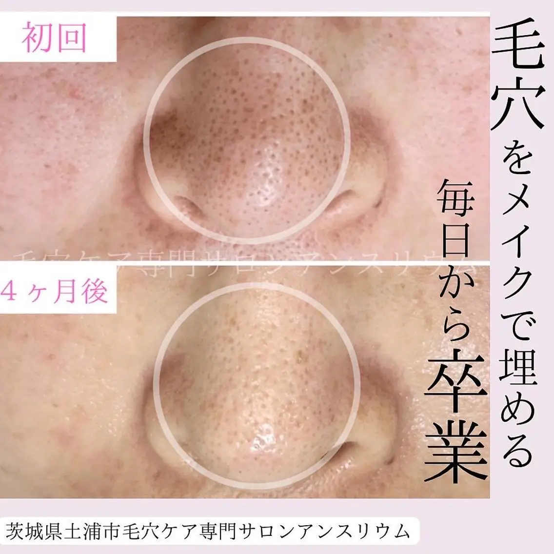 茨城土浦 つくば毛穴 ケア専門サロンのエステ・リラクイメージ