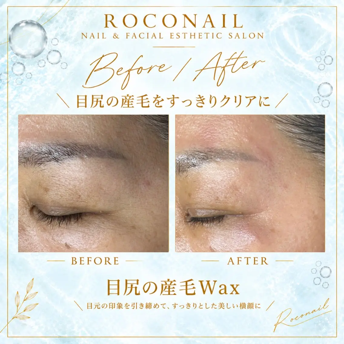 脱毛 roconail& WAX|ヒロコ鎌ヶ谷のエステ・リラクイメージ